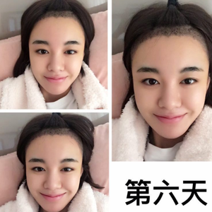发际线分享社区