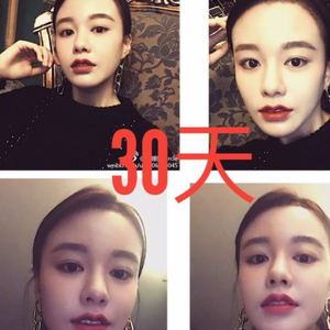 发际线分享社区