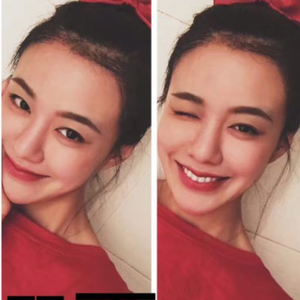 发际线分享社区