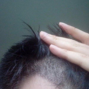 发际线分享社区