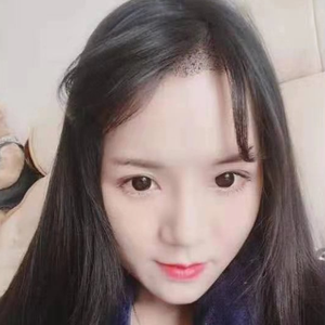 发际线分享社区