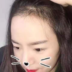 发际线分享社区