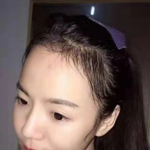发际线分享社区