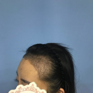 发际线分享社区
