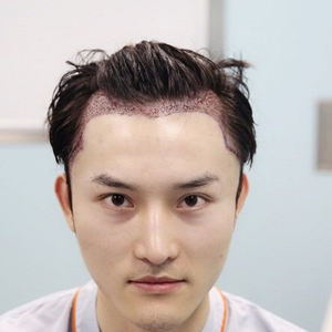 发际线分享社区