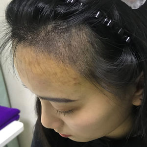 发际线分享社区