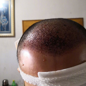 发际线分享社区