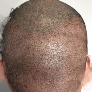 发际线分享社区
