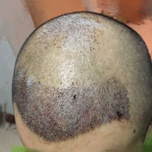 发际线分享社区