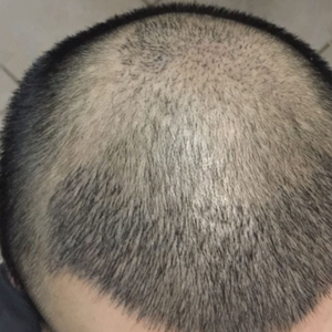 发际线分享社区