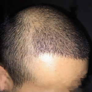 发际线分享社区