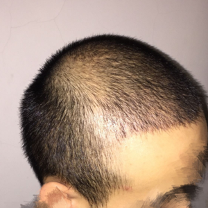 发际线分享社区