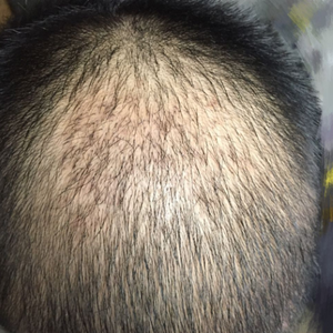 发际线分享社区