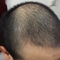 發(fā)際線用戶圖片