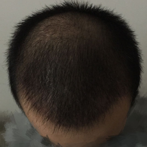 发际线分享社区