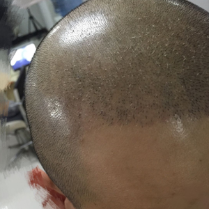 发际线分享社区