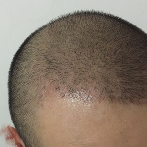 发际线分享社区