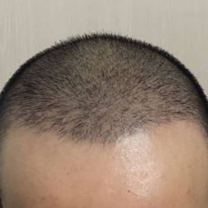 发际线分享社区