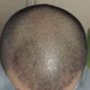 发际线分享社区