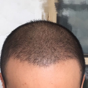 发际线分享社区
