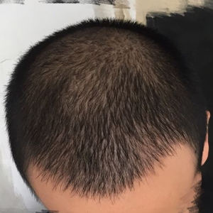 发际线分享社区