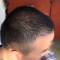 發(fā)際線用戶圖片