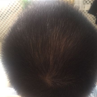 發(fā)際線用戶圖片