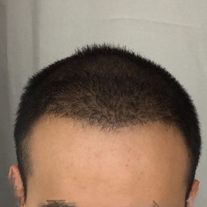 发际线分享社区