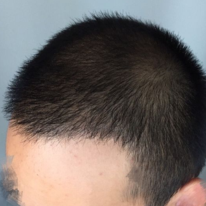 发际线分享社区