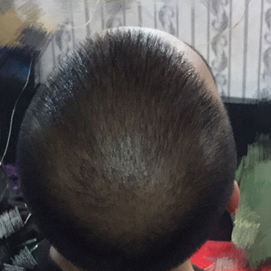 发际线分享社区