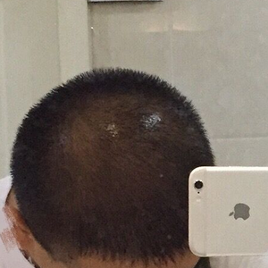 发际线分享社区