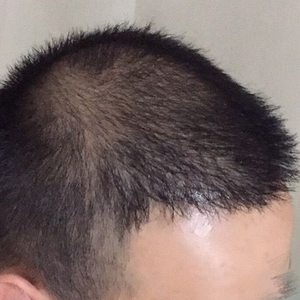 发际线分享社区