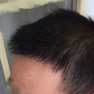 发际线分享社区