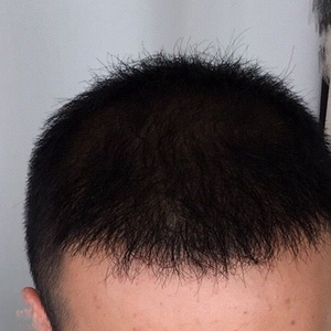发际线分享社区