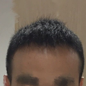 发际线分享社区
