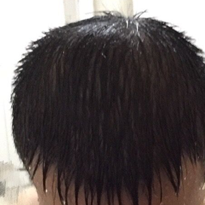 发际线分享社区