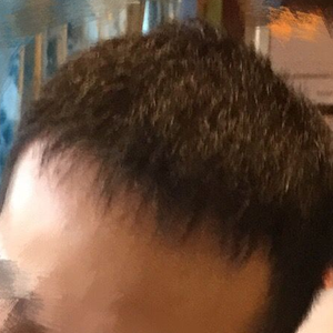 发际线分享社区