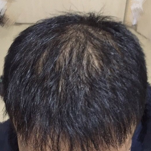 发际线分享社区