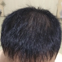 發(fā)際線用戶圖片