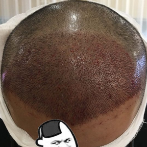 发际线分享社区