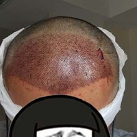 發(fā)際線用戶圖片
