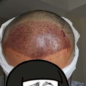 发际线分享社区
