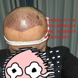 发际线分享社区