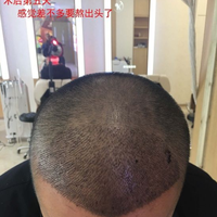 發(fā)際線用戶圖片