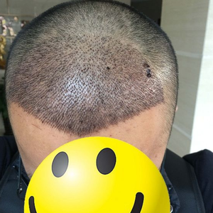 发际线分享社区