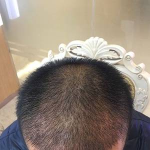 发际线分享社区