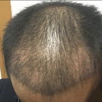 發(fā)際線用戶圖片