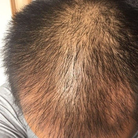 發(fā)際線用戶圖片