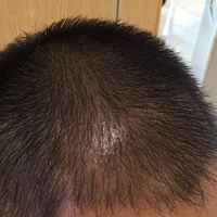 發(fā)際線用戶圖片