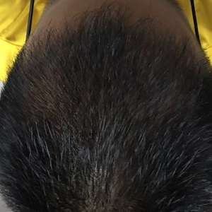 发际线分享社区